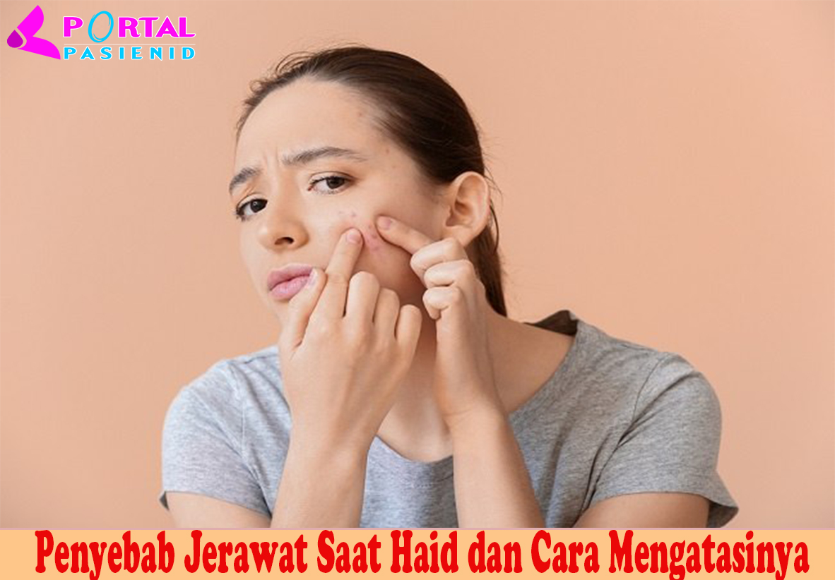 Penyebab Jerawat Saat Haid dan Cara Mengatasinya