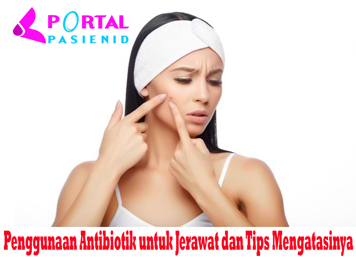 Penggunaan Antibiotik untuk Jerawat dan Tips Mengatasinya