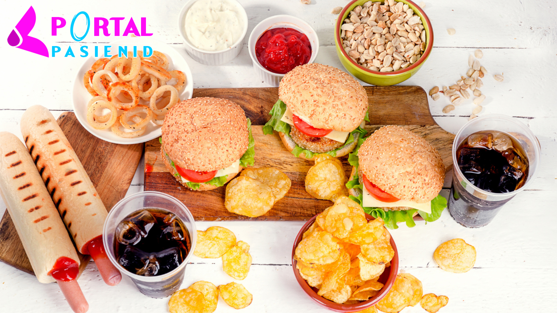 Makanan Penyebab Jerawat yang Sebaiknya Dibatasi Konsumsinya