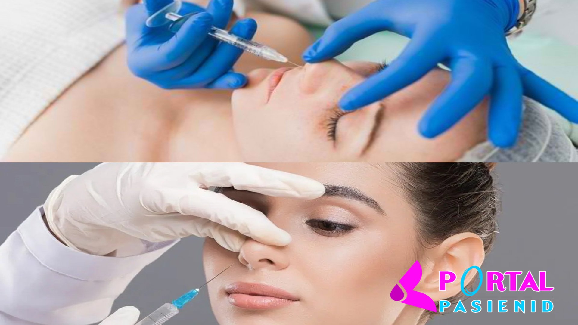 Seputar Filler Hidung yang Perlu Anda Ketahui